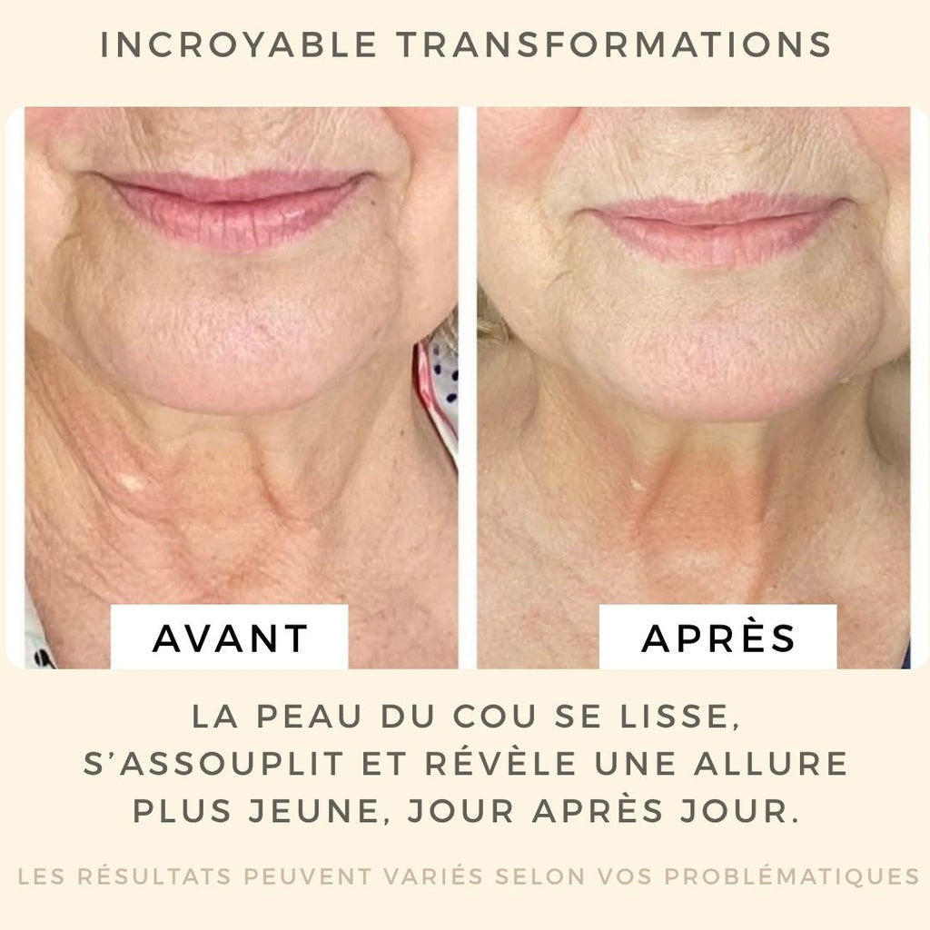 Soin liftant cou et décolleté