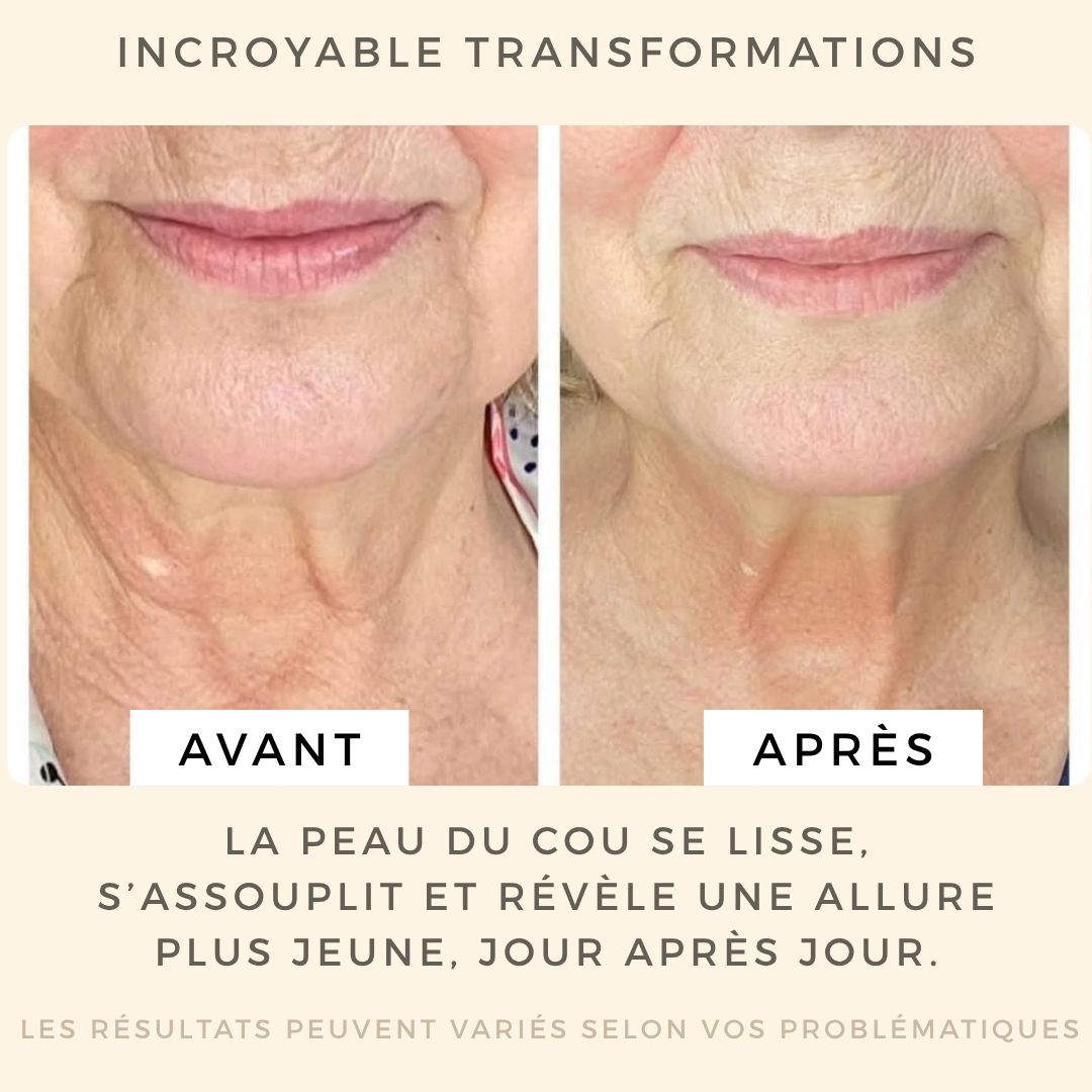 Soin liftant cou et décolleté
