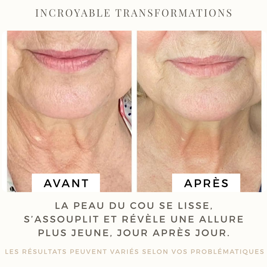 Soin liftant cou et décolleté